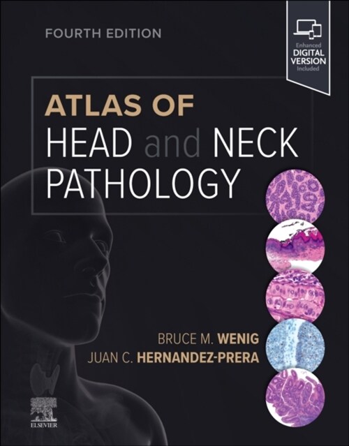 Atlas of Head and Neck Pathology (Hardcover, 4)
