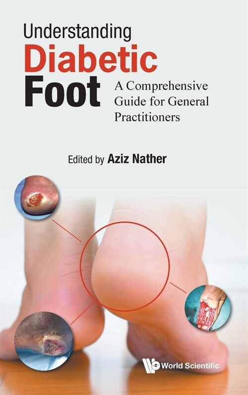 Understanding Diabetic Foot (Hardcover)