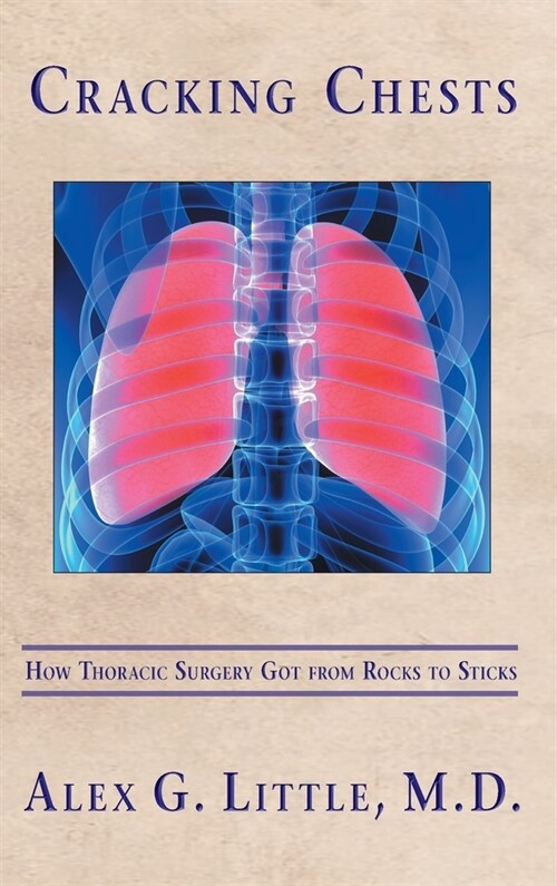 Cracking Chests: How Thoracic Surgery Got from Rocks to Sticks (Hardcover)