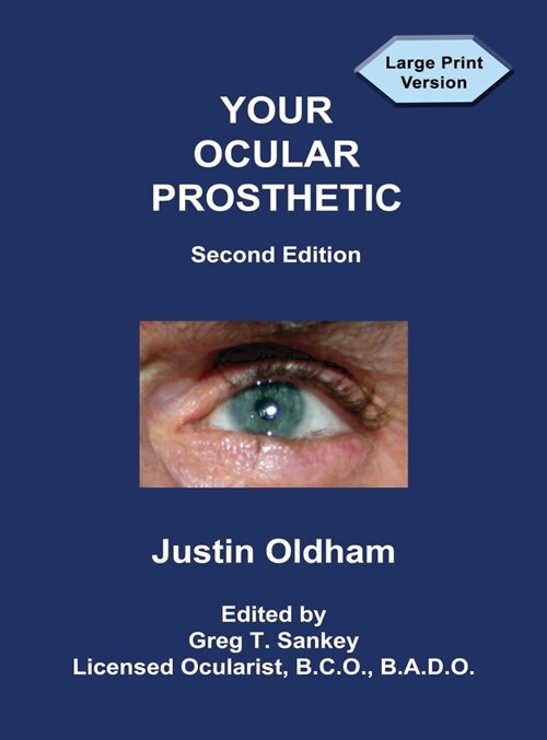 Your Ocular Prosthetic (Hardcover, 2)