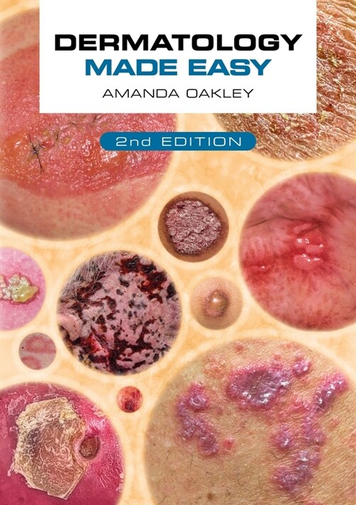 Dermatology Made Easy, Second Edition (Paperback)