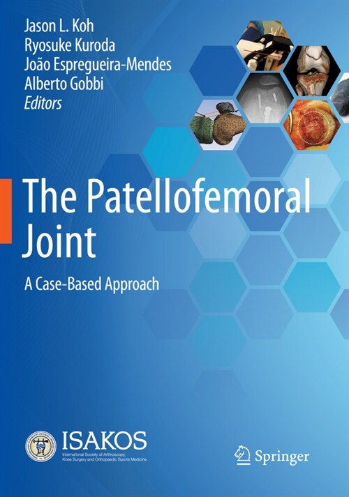 The Patellofemoral Joint: A Case-Based Approach (Paperback, 2022)