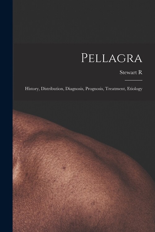 Pellagra: History, Distribution, Diagnosis, Prognosis, Treatment, Etiology (Paperback)