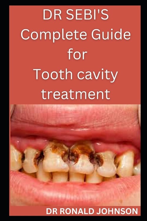 Dr Sebis Complete Guide for Tooth Cavity Treatment (Paperback)