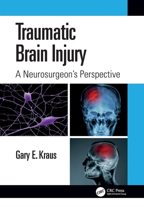 Traumatic Brain Injury: A Neurosurgeons Perspective (Paperback, 1)