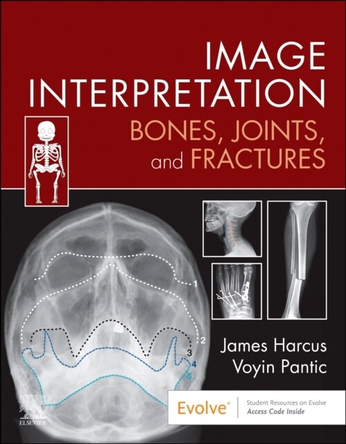 Image Interpretation: Bones, Joints, and Fractures (Paperback)