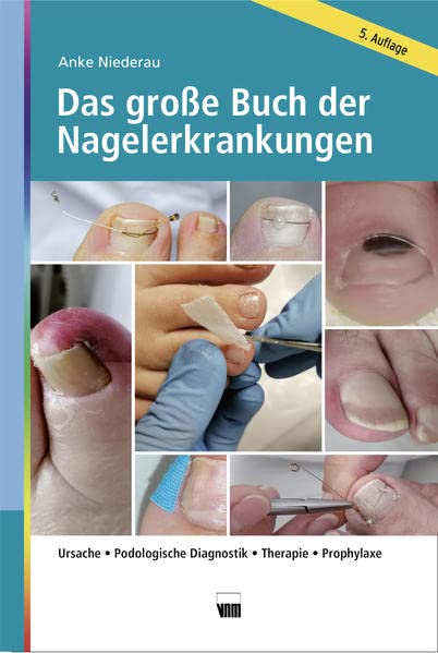 Das große Buch der Nagelerkrankungen: Ursache, Podologische Diagnostik, Therapie, Prophylaxe (Hardcover)