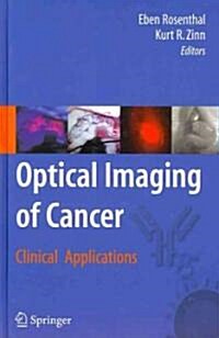 Optical Imaging of Cancer: Clinical Applications (Hardcover)