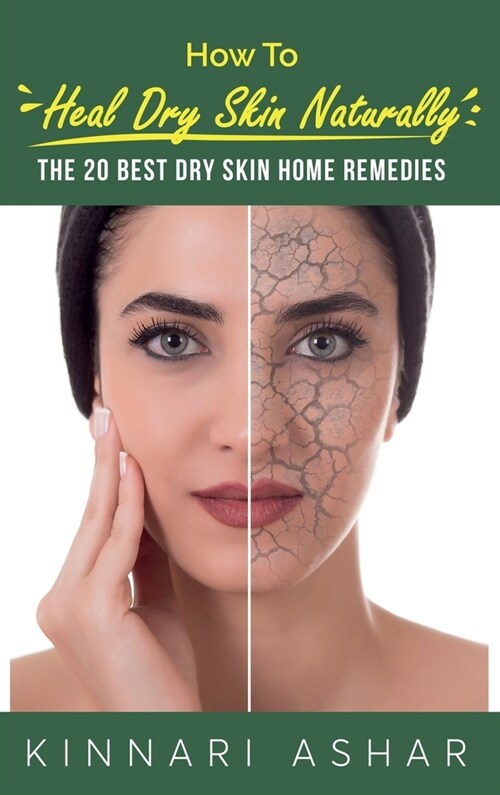 How to Heal Dry Skin Naturally: The 20 Best Dry Skin Home Remedies (Hardcover)