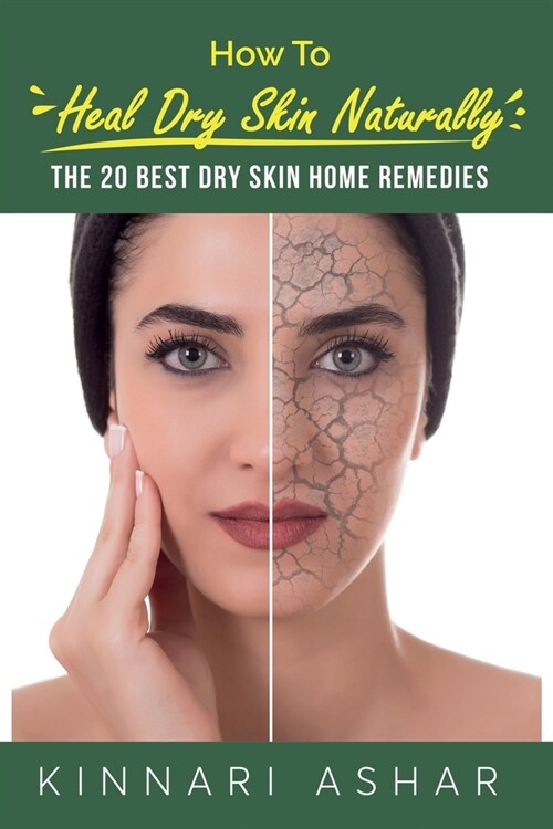 How to Heal Dry Skin Naturally: The 20 Best Dry Skin Home Remedies (Paperback)