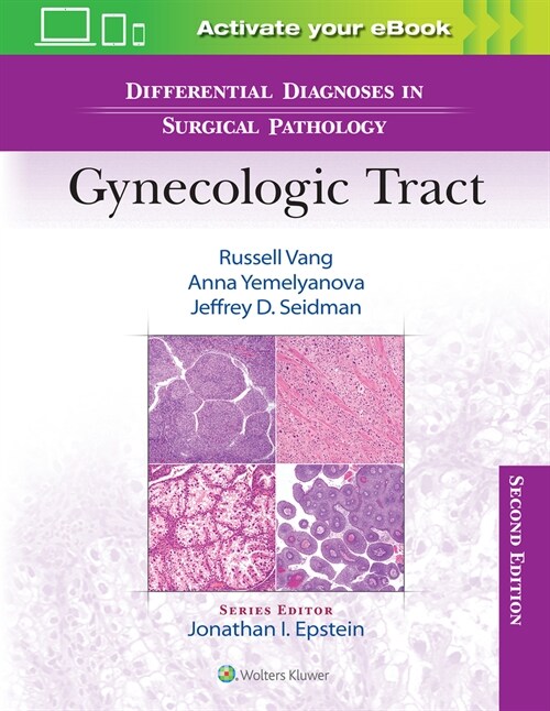 Differential Diagnoses in Surgical Pathology: Gynecologic Tract (Hardcover, 2)