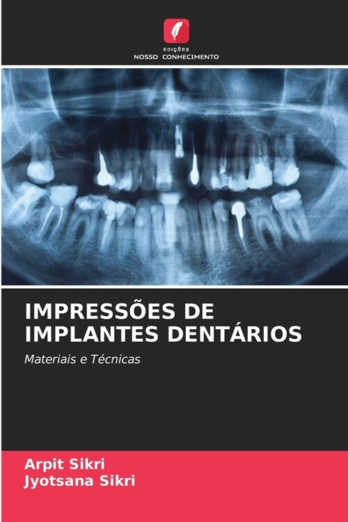 Impress?s de Implantes Dent?ios (Paperback)