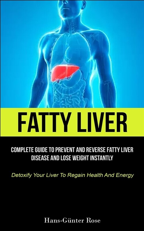 Fatty Liver: Complete Guide To Prevent And Reverse Fatty Liver Disease And Lose Weight Instantly (Detoxify Your Liver To Regain Hea (Paperback)