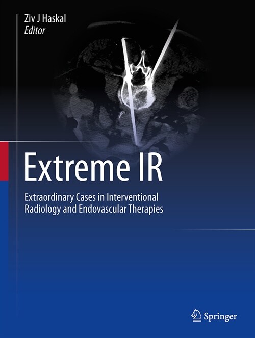 Extreme IR: Extraordinary Cases in Interventional Radiology and Endovascular Therapies (Hardcover, 2023)