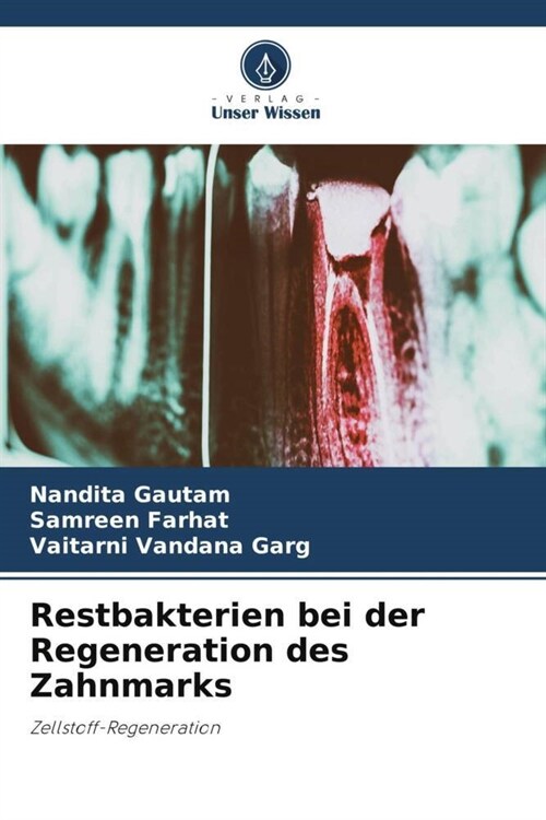 Restbakterien bei der Regeneration des Zahnmarks (Paperback)