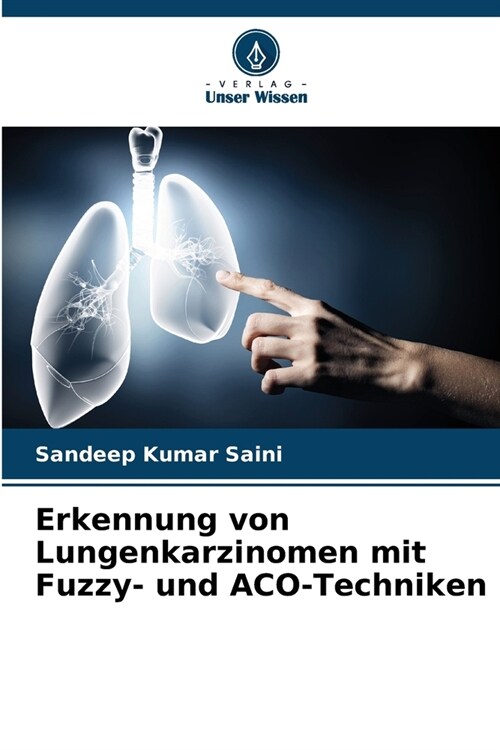 Erkennung von Lungenkarzinomen mit Fuzzy- und ACO-Techniken (Paperback)