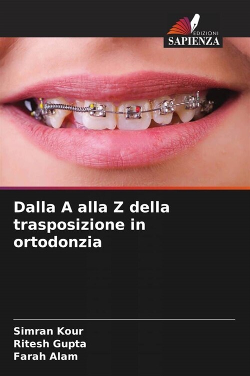 Dalla A alla Z della trasposizione in ortodonzia (Paperback)