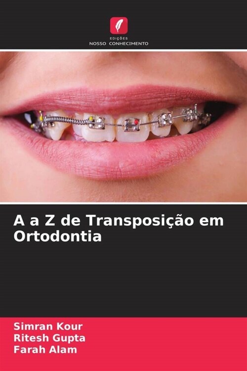 A a Z de Transposi豫o em Ortodontia (Paperback)
