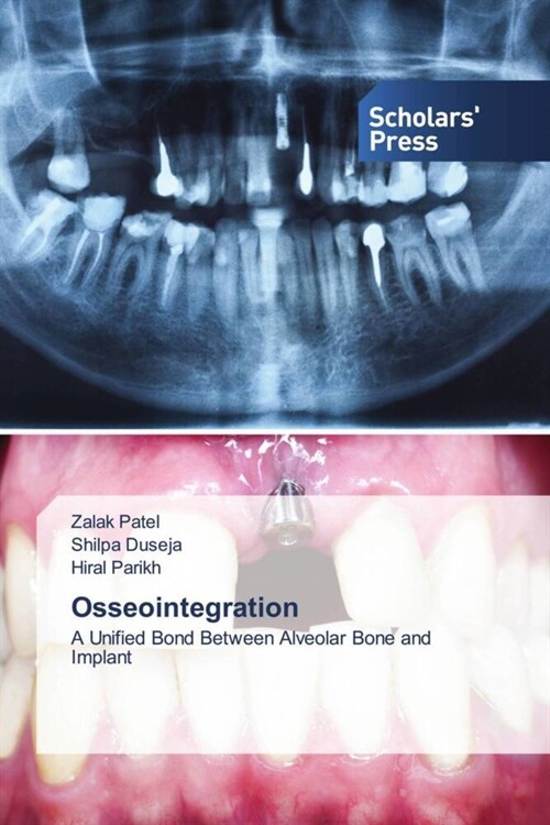 Osseointegration (Paperback)