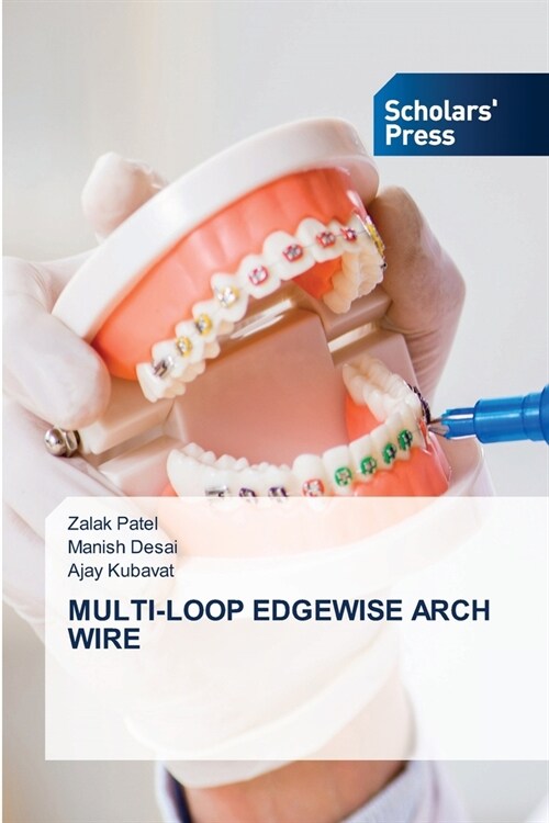 Multi-Loop Edgewise Arch Wire (Paperback)