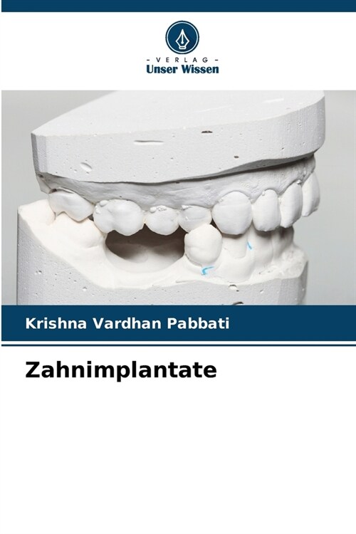 Zahnimplantate (Paperback)