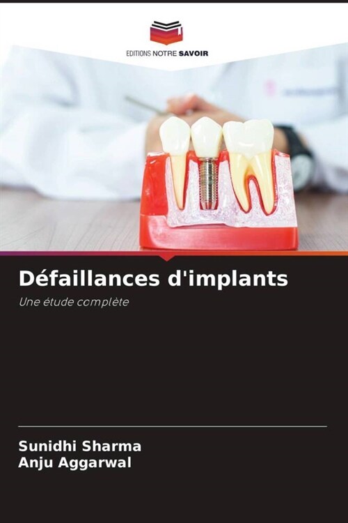 D?aillances dimplants (Paperback)