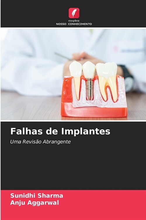 Falhas de Implantes (Paperback)