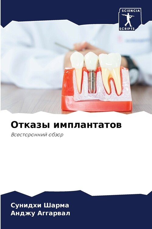 Отказы имплантатов (Paperback)