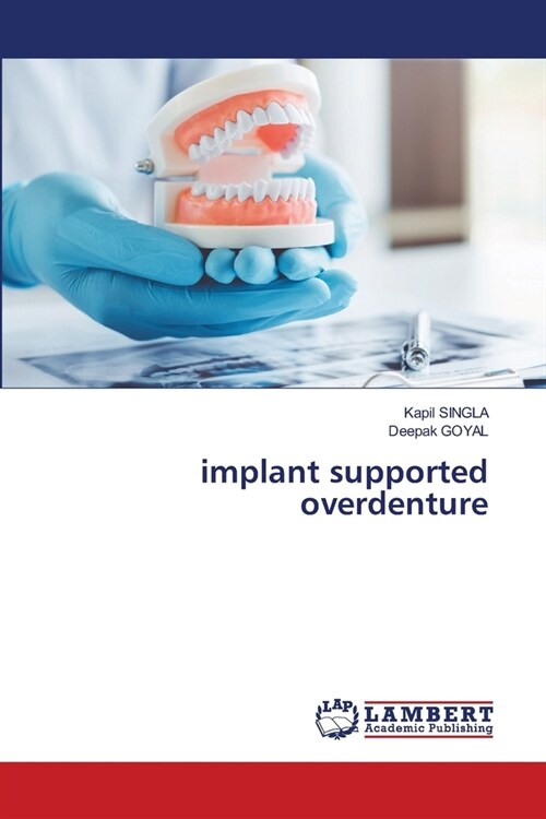 implant supported overdenture (Paperback)