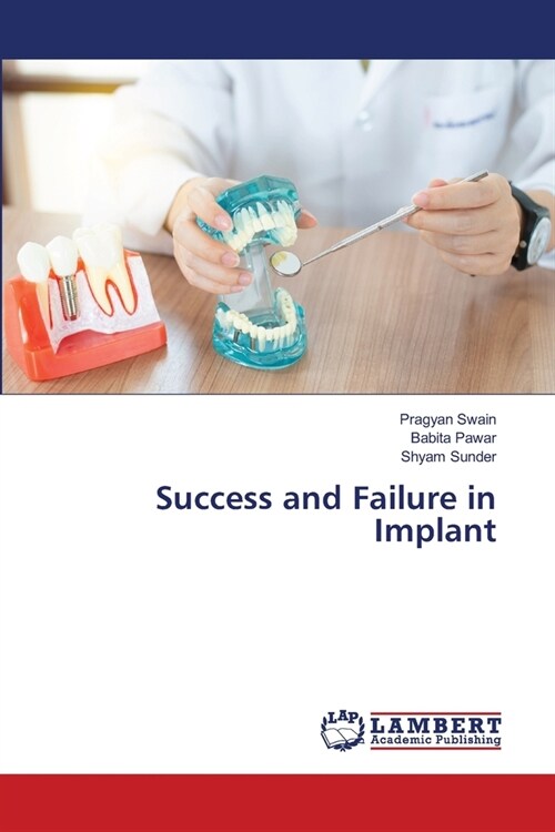 Success and Failure in Implant (Paperback)