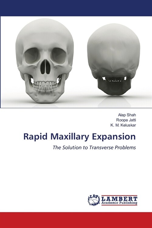 Rapid Maxillary Expansion (Paperback)