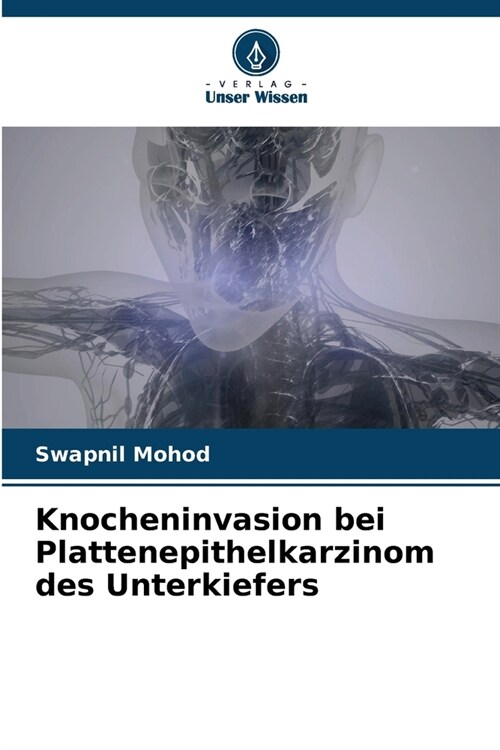 Knocheninvasion bei Plattenepithelkarzinom des Unterkiefers (Paperback)