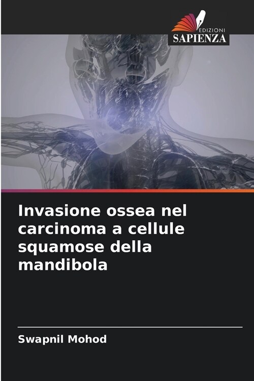 Invasione ossea nel carcinoma a cellule squamose della mandibola (Paperback)