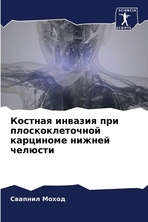 Костная инвазия при плос (Paperback)