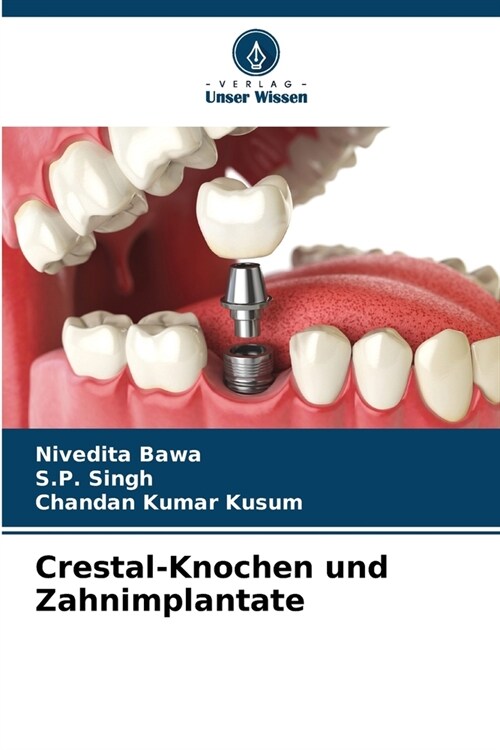 Crestal-Knochen und Zahnimplantate (Paperback)