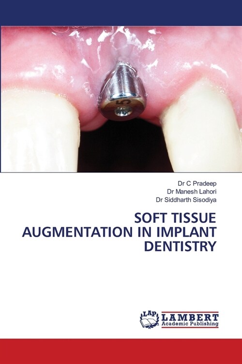 Soft Tissue Augmentation in Implant Dentistry (Paperback)