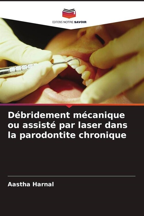 D?ridement m?anique ou assist?par laser dans la parodontite chronique (Paperback)