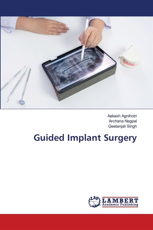 Guided Implant Surgery (Paperback)