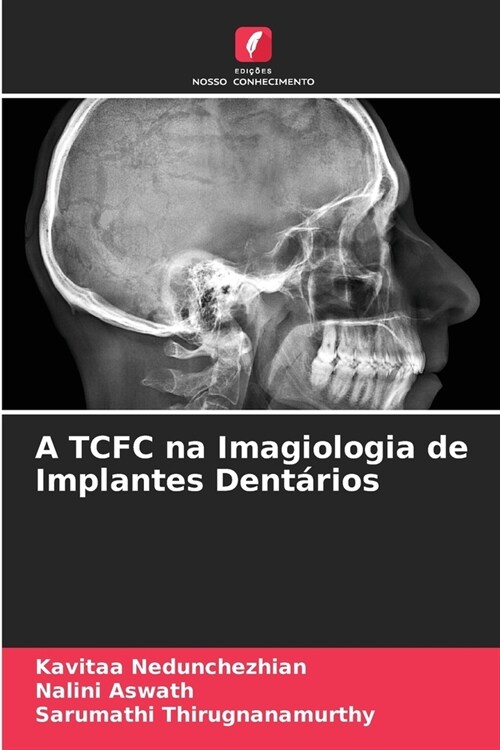 A TCFC na Imagiologia de Implantes Dent?ios (Paperback)