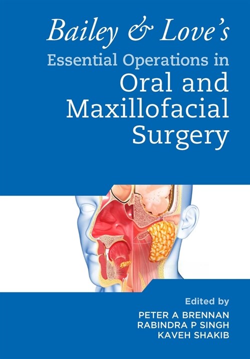 Bailey & Loves Essential Operations in Oral & Maxillofacial Surgery (Paperback)