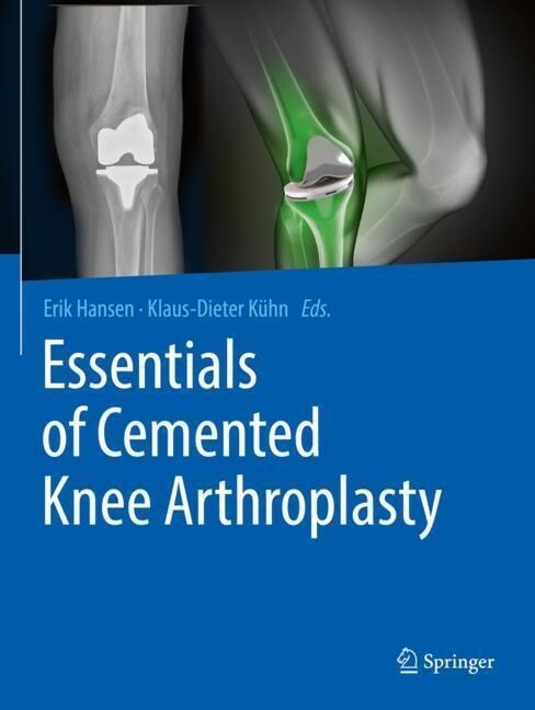 Essentials of Cemented Knee Arthroplasty (Paperback, 2022)