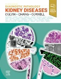 Diagnostic Pathology: Kidney Diseases (Hardcover, 4 ed)