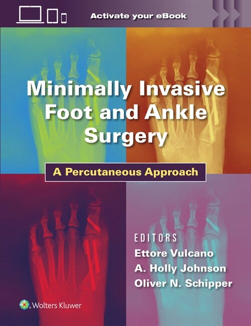 Minimally Invasive Foot and Ankle Surgery: A Percutaneous Approach (Hardcover)