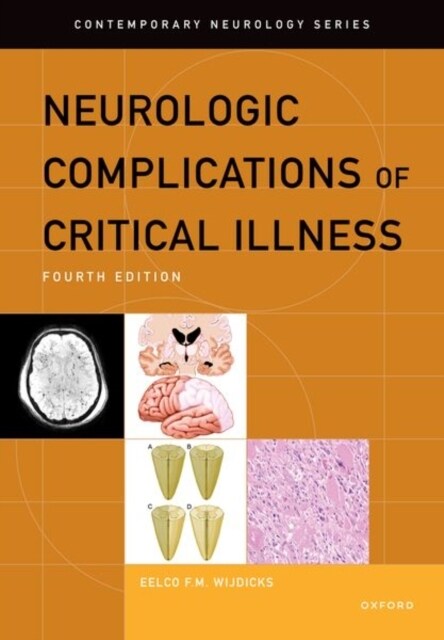 Neurologic Complications of Critical Illness (Hardcover, 4)