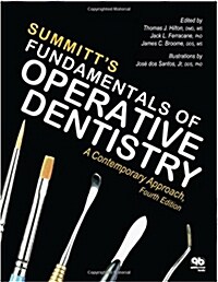 Summitts Fundamentals of Operative Dentistry: A Contemporary Approach (Hardcover, 4, Revised)