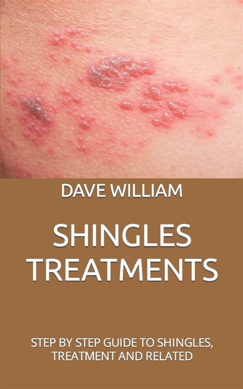 Shingles Treatments: Step by Step Guide to Shingles, Treatment and Related (Paperback)