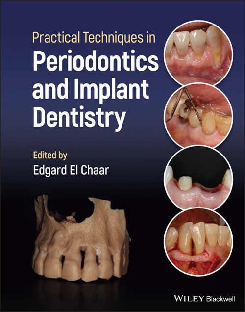 [eBook Code] Practical Techniques in Periodontics and Implant Dentistry (eBook Code, 1st)