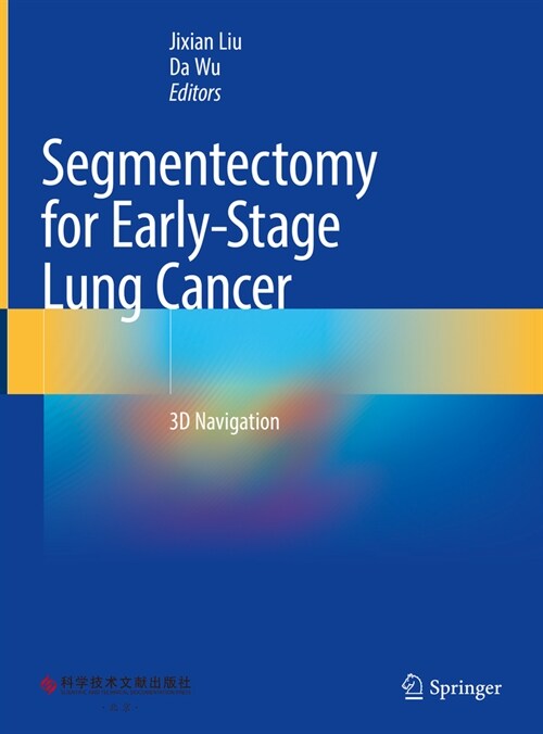 Segmentectomy for Early-Stage Lung Cancer: 3D Navigation (Hardcover, 2023)