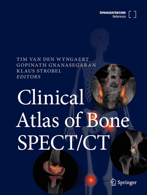 Clinical Atlas of Bone SPECT/CT (Hardcover)