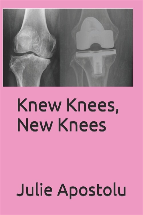 Knew Knees, New Knees (Paperback)